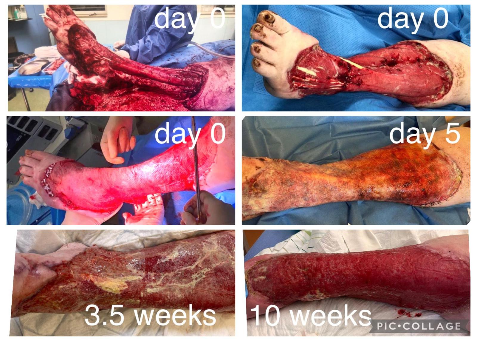 Myriad™ – OP/Weichgewebe Anwendungskontext