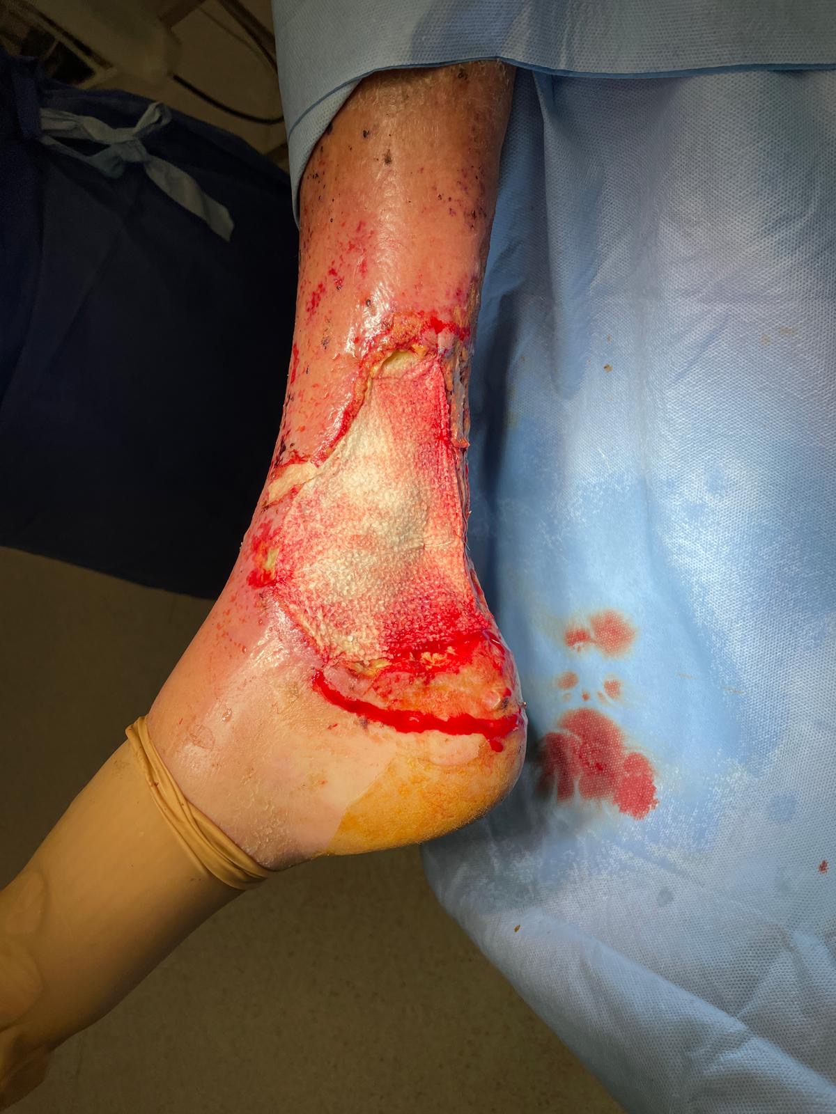 Myriad™ – Produktdetail