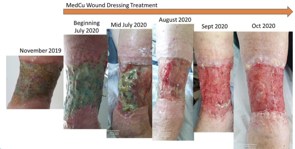 MEDCu™ Bild 01