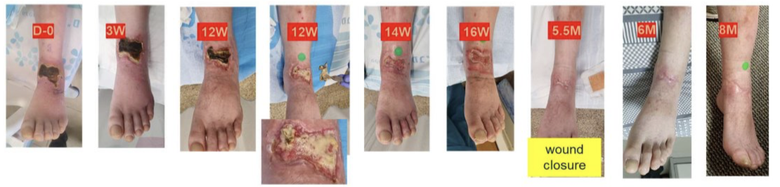 MEDCu™ Bild 08